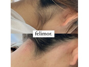 フェリモール(Felimor.)/シュガーリングbefore／after