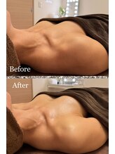 プリマベラ 大阪梅田(primabella)/バストアップと巻肩改善