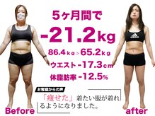 美容整体院元 光の森店