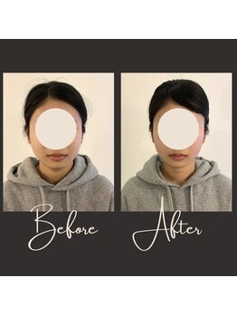 ユジュアンド(YUJ&)/【20代】ビフォーアフター