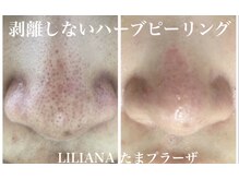 リリアーナ(LILIANA)の雰囲気（毛穴ケア/シミケア／ハーブピーリング・くすみ緩和・ブライダル）