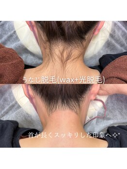 ナナイロサロン ニコリー(NaNairo nicolly)/【襟足.うなじワックス+光脱毛】