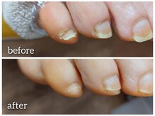 爪切り屋 足楽/乾燥する爪まわり