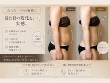 サハスラーラ(SAHASRARA)