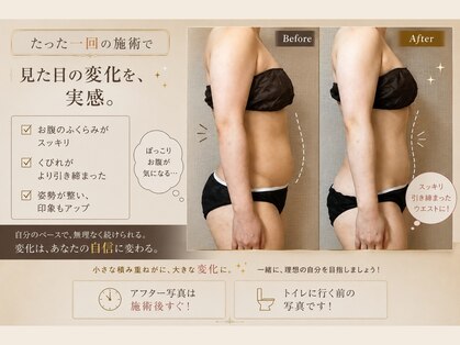 サハスラーラ(SAHASRARA)の写真