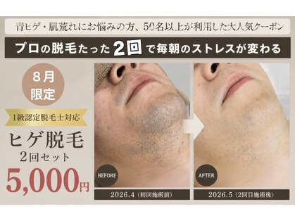 フォー(the 4)の写真