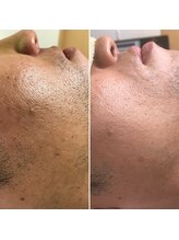 パーソナルエステティックサロン リボーン(ReBorn)/