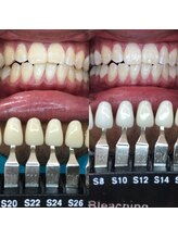 トウキョースワーズ 渋谷店(TOKYO SWRS)/#ホワイトニング #渋谷 #池袋