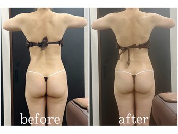 サロン ラズリ 久留米店(SALON Lazuli)/【痩身】肩こり/腰痛にも期待◎