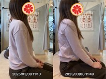 グレフル鍼灸接骨院 整体院 心斎橋/