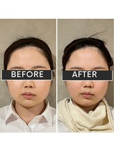 キュープ 富士店(Qpu)/オイルコース1回で♪富士市/小顔