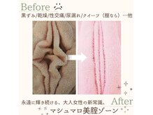 ホットナンバー(HOT number)