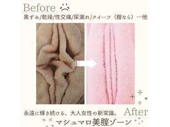 ホットナンバー(HOT number)