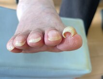 巻き爪じゅん 千葉駅前店