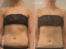 ユーフォリア グロウ(euphoria glow)/｛　ラフォス痩身90分 24回　}