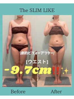 スリムライク 鳥取店(The SLIM LIKE)/痩身ビフォーアフター