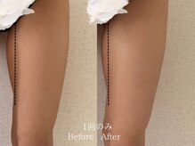 サロン ド ビビ(salon de bibi*)の雰囲気（「ここだけ痩せない...」のお悩みも。脂肪細胞“ごと”減らす！）