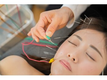 あかり鍼灸接骨院の写真/40代以上の悩みに強い！電気を流す美容鍼お試し￥3980！早い効果×高技術でお客様満足度◎
