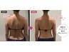 最新ウィンバック癒着が強い慢性首肩こり＆姿勢改善体験50分コース★