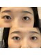 アールイープラス(RE+)の写真/今まで上がらなかったまつげもお任せください