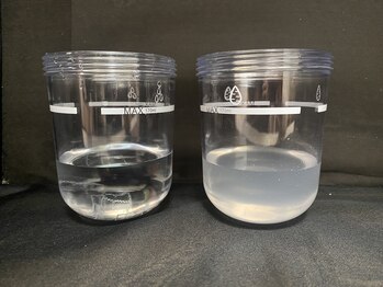 うつくし痩身 美サロン ゼットワン(Z-ONE)/ハイドロ　before after