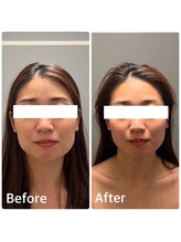 シロ チューズミー(Shiro choose me)/気になるたるみにも効果抜群！