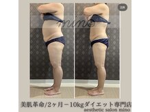 ミノ 美里大通り店(mino)/ダイエットパッケージ
