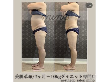ミノ 美里大通り店(mino)/ダイエットパッケージ