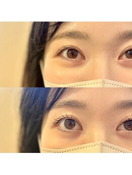 ベル フルール(Bell Fleur)/パリジェンヌ施術前後