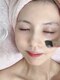 グランルリエ(Gran Rurier)の写真/【渡韓せず赤坂で美肌育成！】大人女性向け上質空間でララピール＆ポテンツァをご提供！憧れの艶玉肌へ。