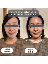 ウーマンビーヘルス(woman Be Health)/オーダーメイド美容鍼灸90分