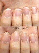 マリーロール 淀屋橋本店(Marie Laure)/自爪育成/深爪矯正/ネイルケア