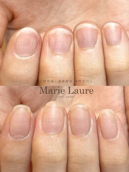 マリーロール 淀屋橋本店(Marie Laure)/自爪育成/深爪矯正/ネイルケア