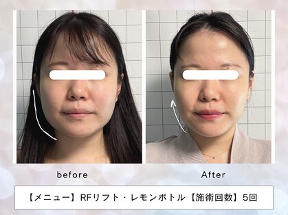 レッド(RED)の写真