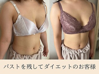 ラーナ(Lana)/【バストアップ】症例♪