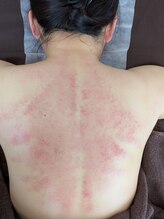 エン(EN)/肩こり解消かっさ