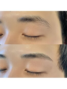 インファーマリィ(i n f i r m a r y)/柔らかい印象に