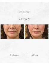 ねこのひげ/お客様の変化