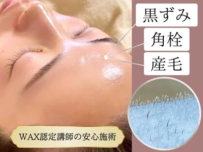 ラナ(Lana)の写真