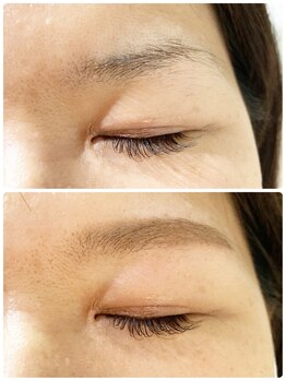 バードアイ(bird eye)/眉スタリング