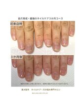 シープラス/爪が弱い、割れやすい方の爪育成