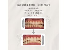 プラスビーセルフ(+b self)/ホワイトニングビフォーアフター