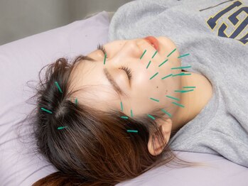 たきもと鍼灸整骨院の写真/【初めての方も◎】体の凝り/睡眠/自律神経を整え体の内側から健康を促進☆美容鍼￥3300