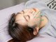 たきもと鍼灸整骨院の写真/【初めての方も◎】体の凝り/睡眠/自律神経を整え体の内側から健康を促進☆美容鍼￥3300