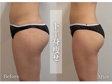 シューラディアント(ShuRadiant)/お悩み別に部分ケア！県内初導入