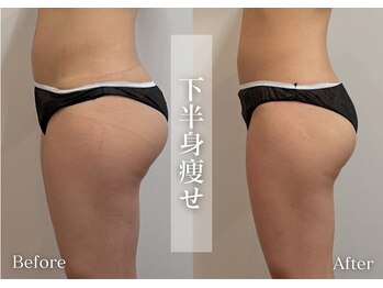 シューラディアント(ShuRadiant)/お悩み別に部分ケア！県内初導入