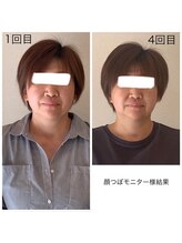 グラナダ 2F(Granada)/