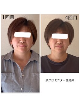 グラナダ 2F(Granada)/