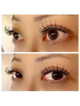 アアルズ(R’s)/