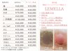 ルメラ【乳輪】黒ずみ・くすみ除去　